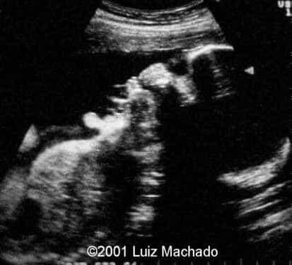 case0057-1