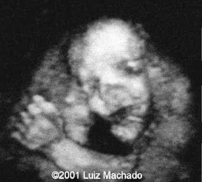 case0057-2