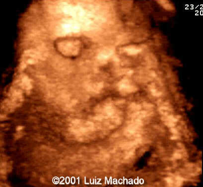 case0057-3