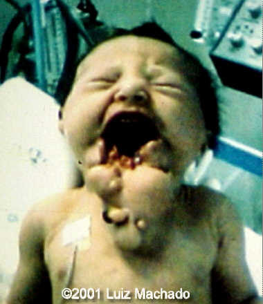 case0057-7