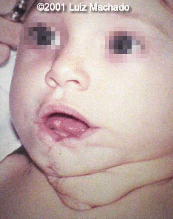 case0057-8