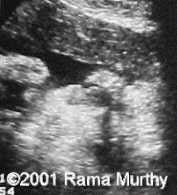 case0059-2