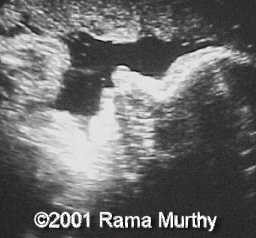 case0059-3