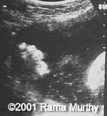 case0059-4