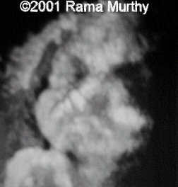 case0059-5