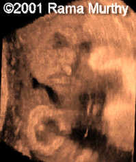 case0059-6