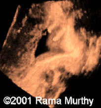 case0059-7