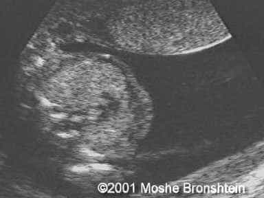 case0060-1