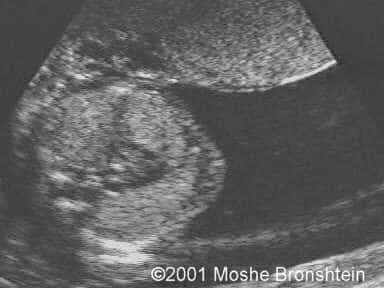 case0060-2