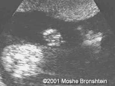 case0060-5