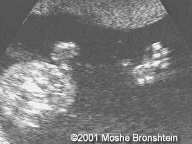 case0060-6