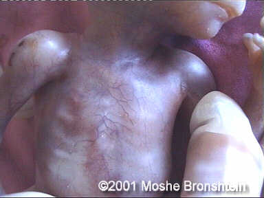 case0060-7