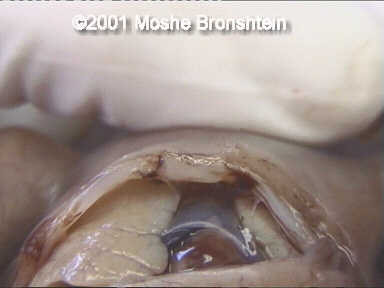 case0060-9
