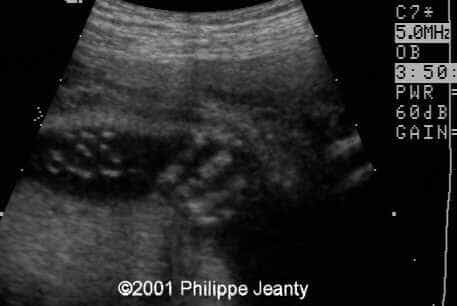 case0061-1