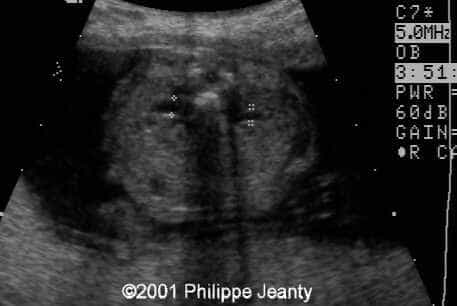 case0061-3