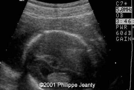 case0061-4
