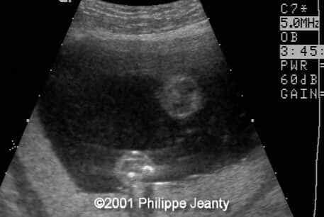 case0061-5