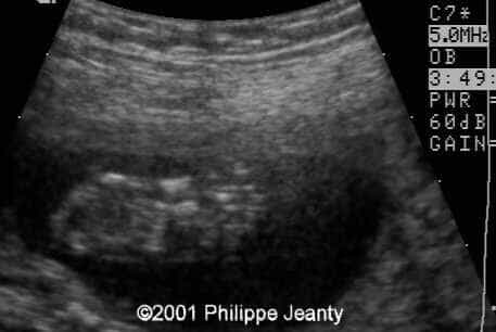 case0061-7