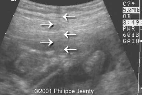 case0061-9
