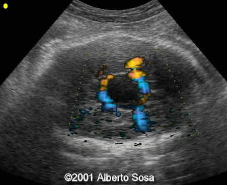 Case0062-10