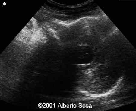 Case0062-12