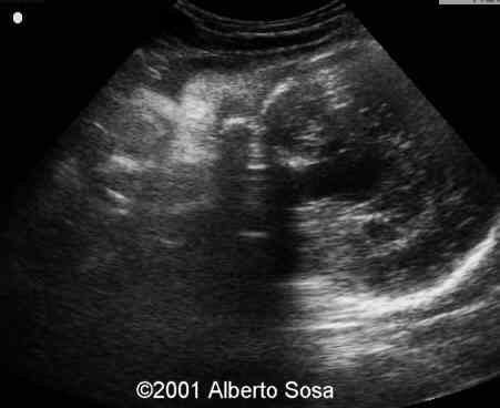 Case0062-13