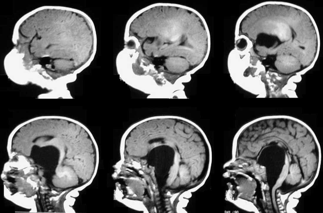 Case0062-14
