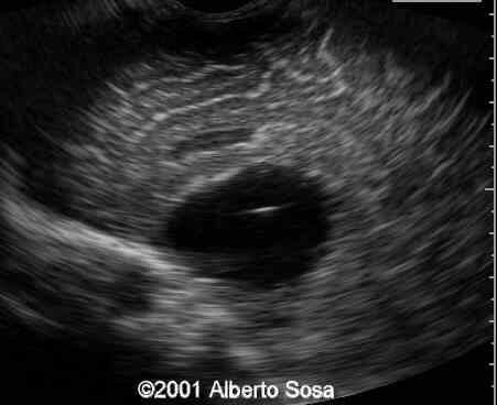 Case0062-2
