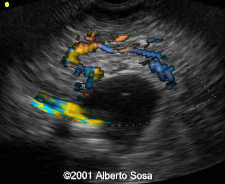 Case0062-5