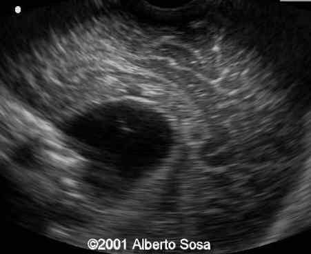 Case0062-6
