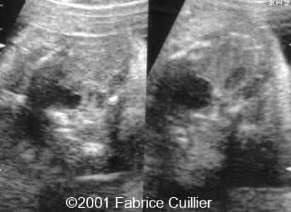 case0063-2