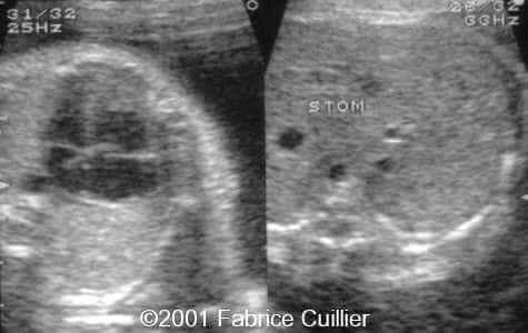 case0063-3
