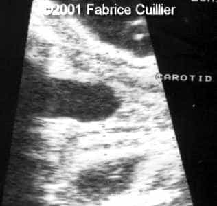 case0063-6