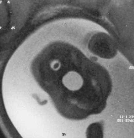 case0063-7