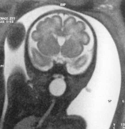 case0063-8