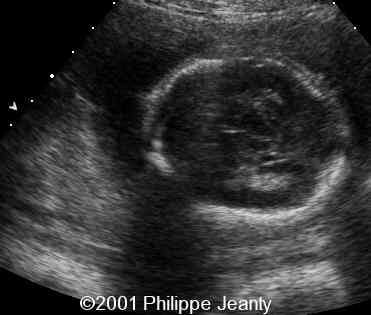 case0064-1