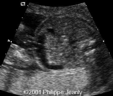 case0064-10