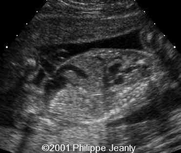 case0064-11