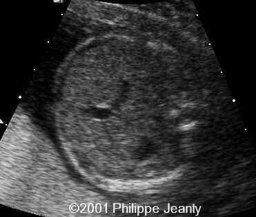 case0064-2