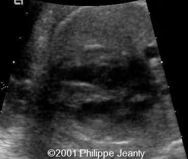 case0064-3