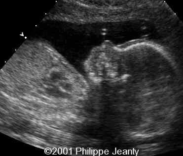 case0064-4