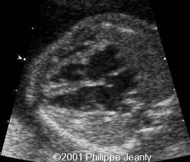 case0064-5