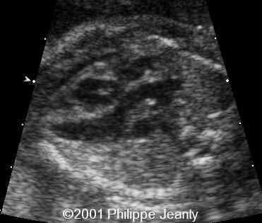 case0064-6