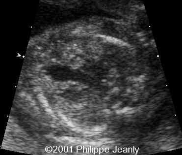 case0064-7