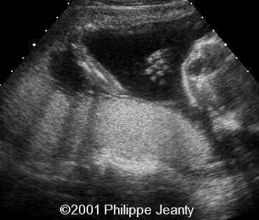 case0064-8