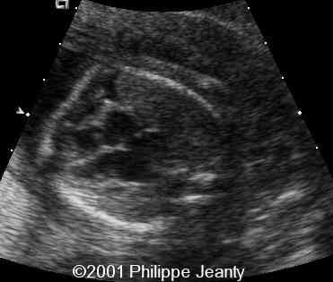 case0064-9