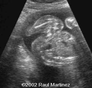 case0066-1