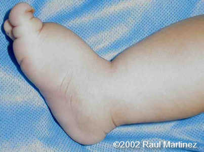 case0066-10