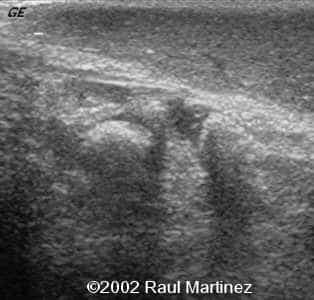 case0066-11