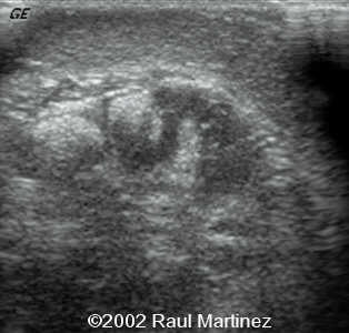 case0066-13